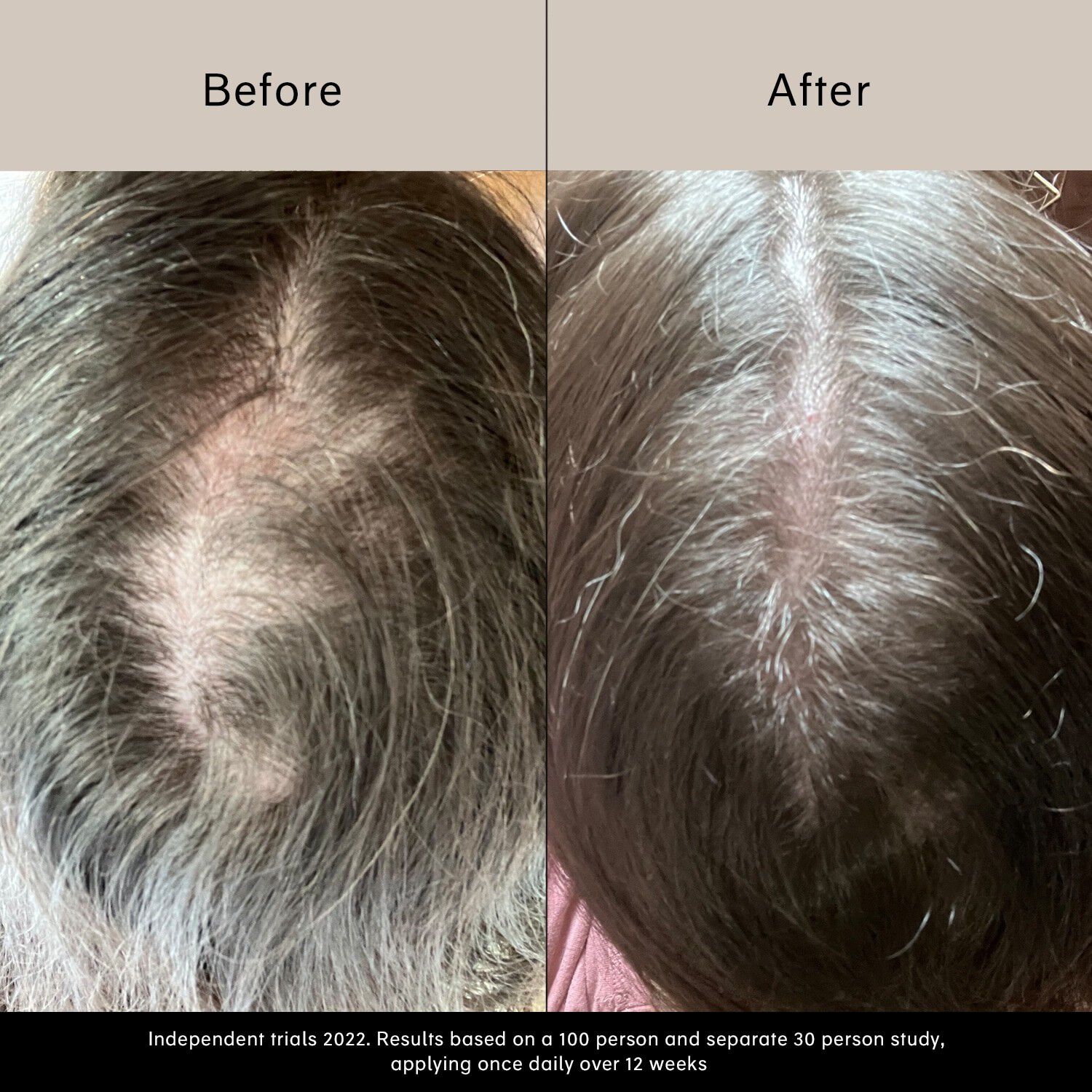 Pitta v&aelig;kstserum - V&aelig;kstserum