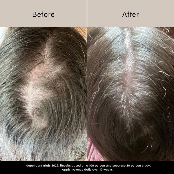 Pitta vækstserum - Vækstserum