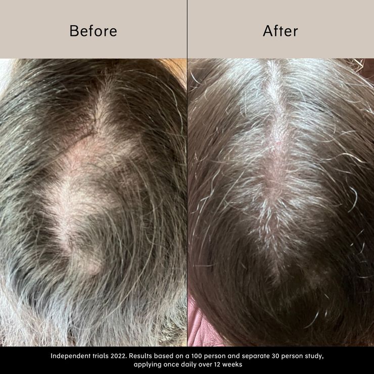 Pitta vækstserum - Vækstserum