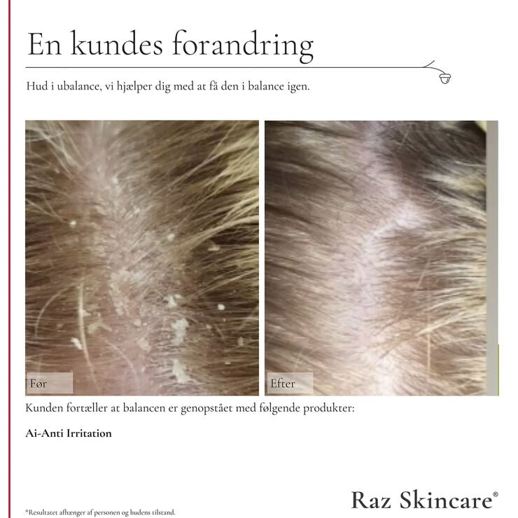 Raz Skincare Ai - Anti Irritation 300 ml