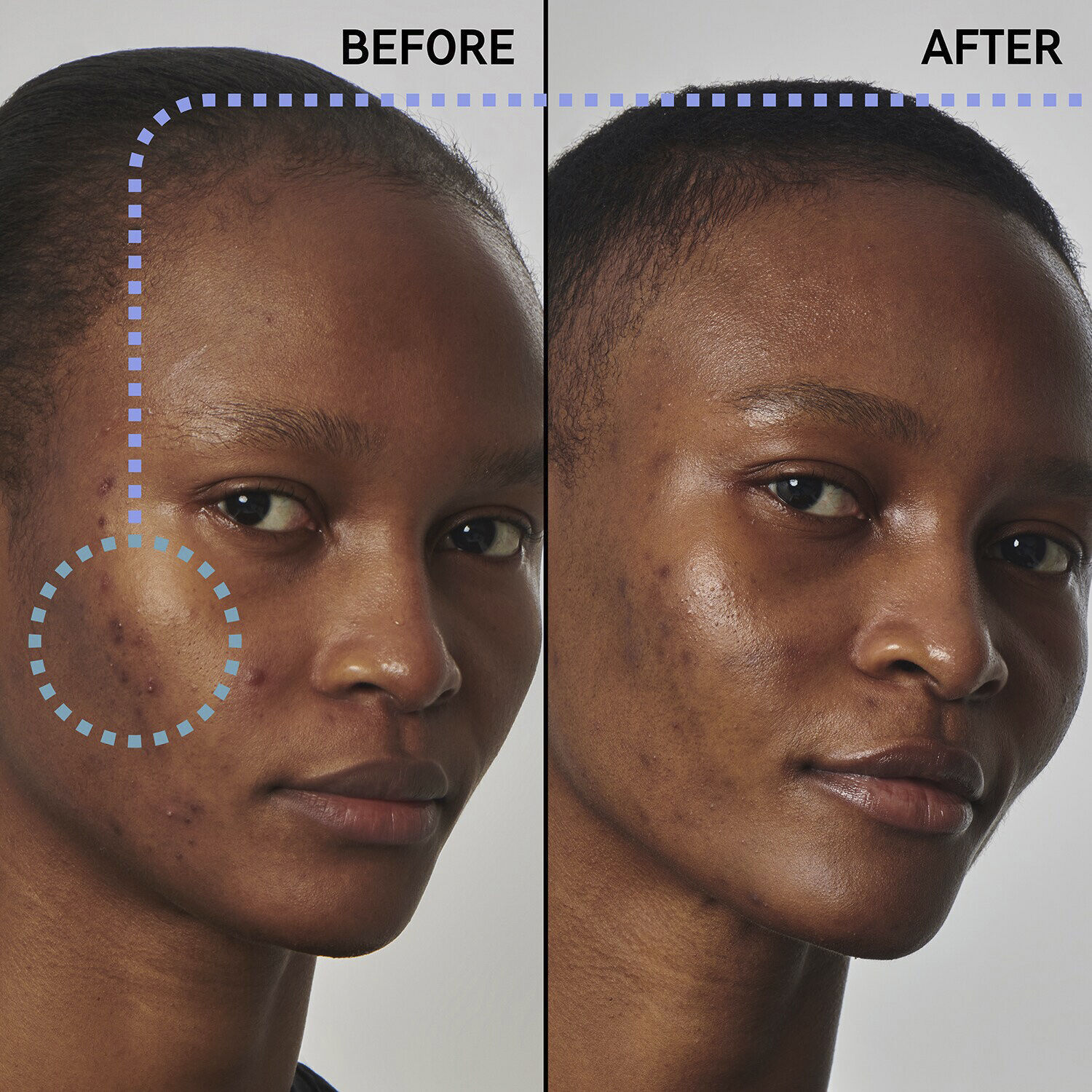 Excess oil solution with 20% niacinamide - Face serum