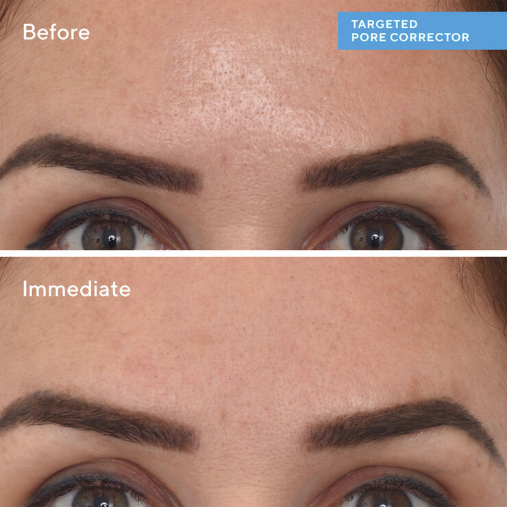 Targeted PoreCorrector 15 ml