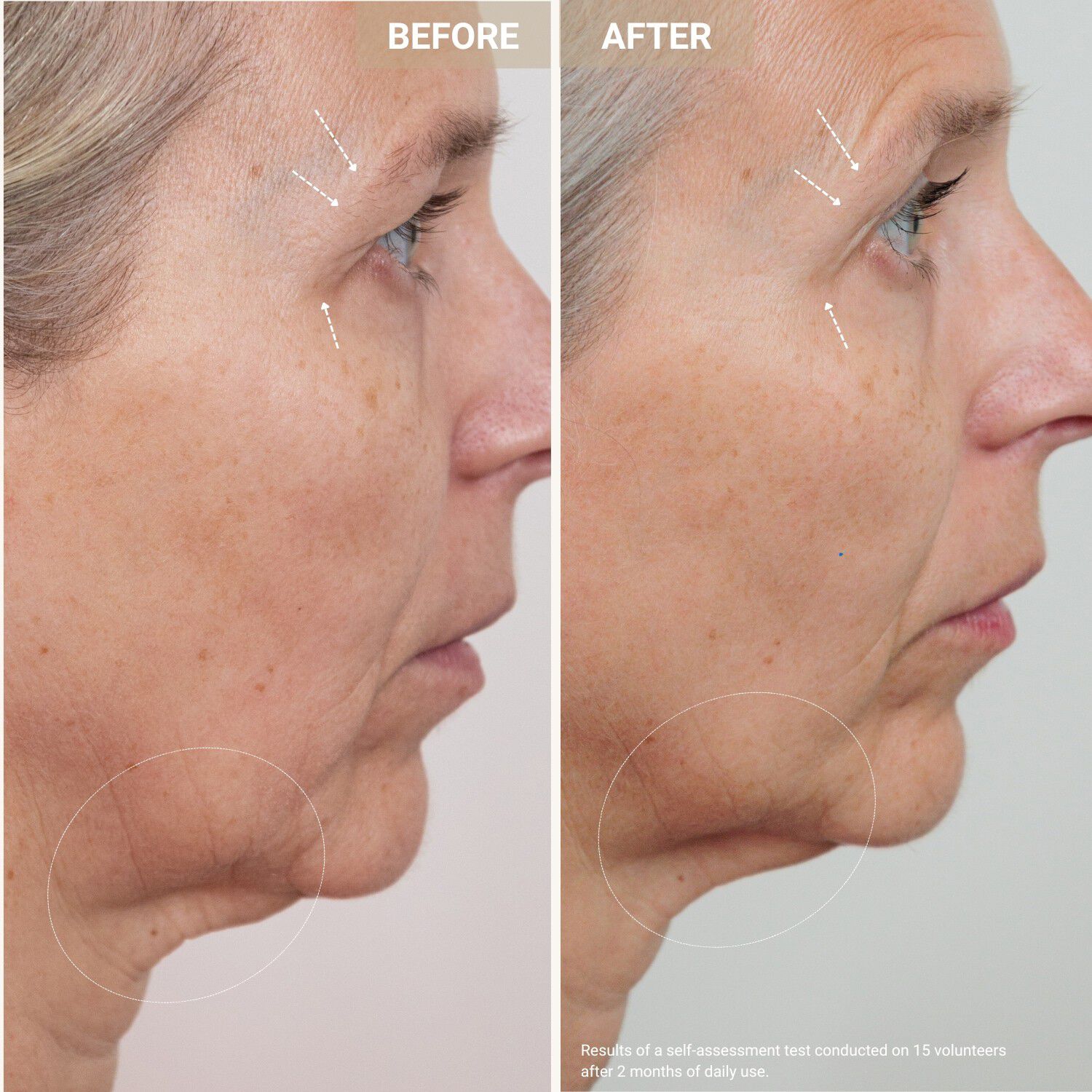 Youth Serum - Anti-aging serum med kobberpeptider