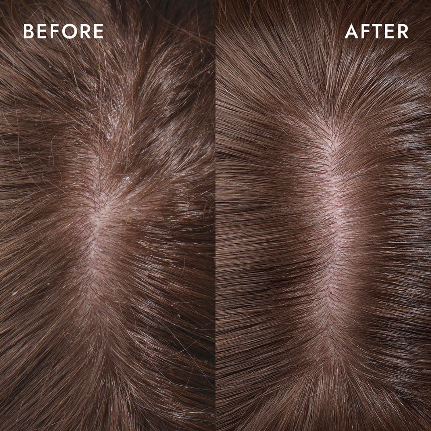 Cure Scalp Serum - Scalp Restoring Formula