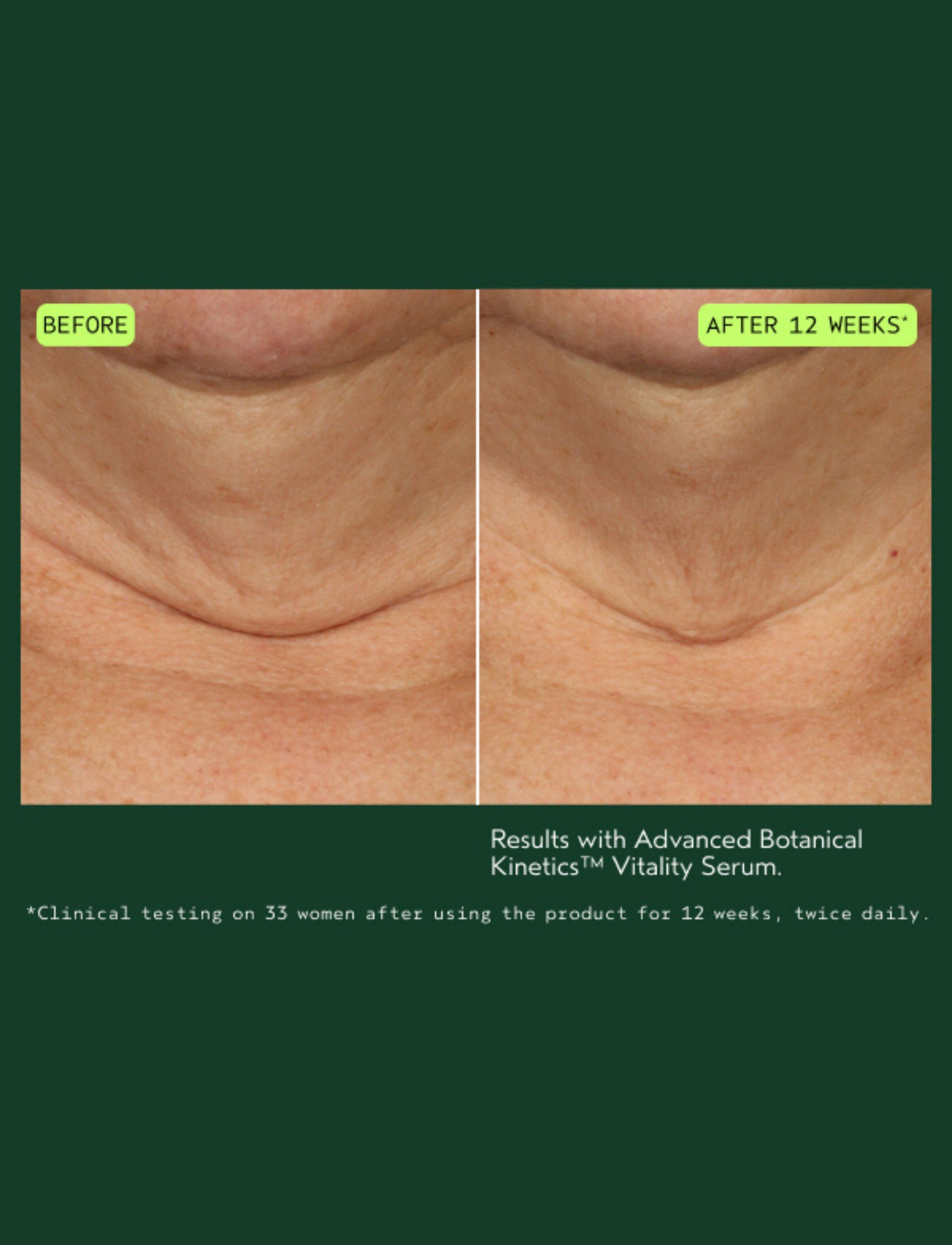 Advanced Botanical Kinetics&trade; Vitality Serum 30 ml