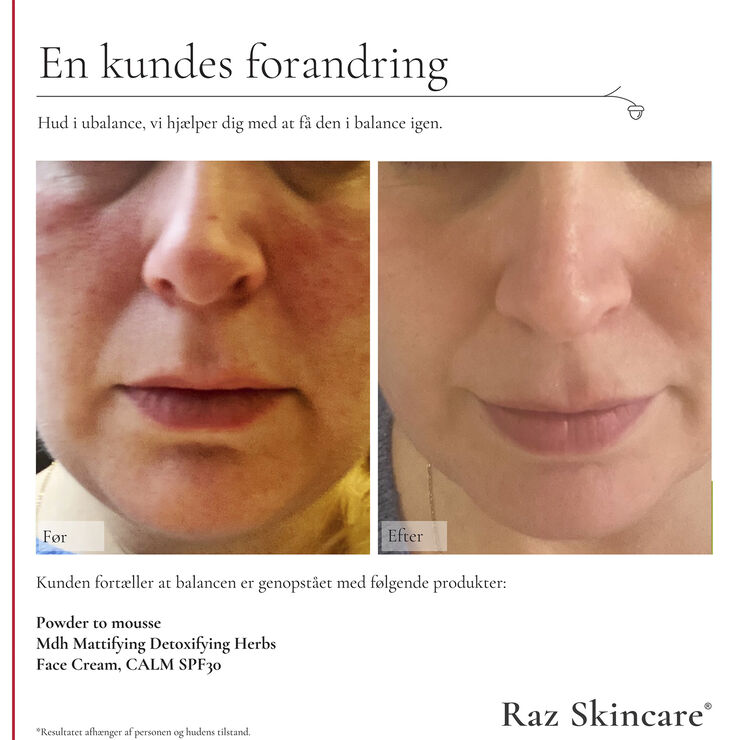 Raz Skincare Face Cream, CALM 50 ml