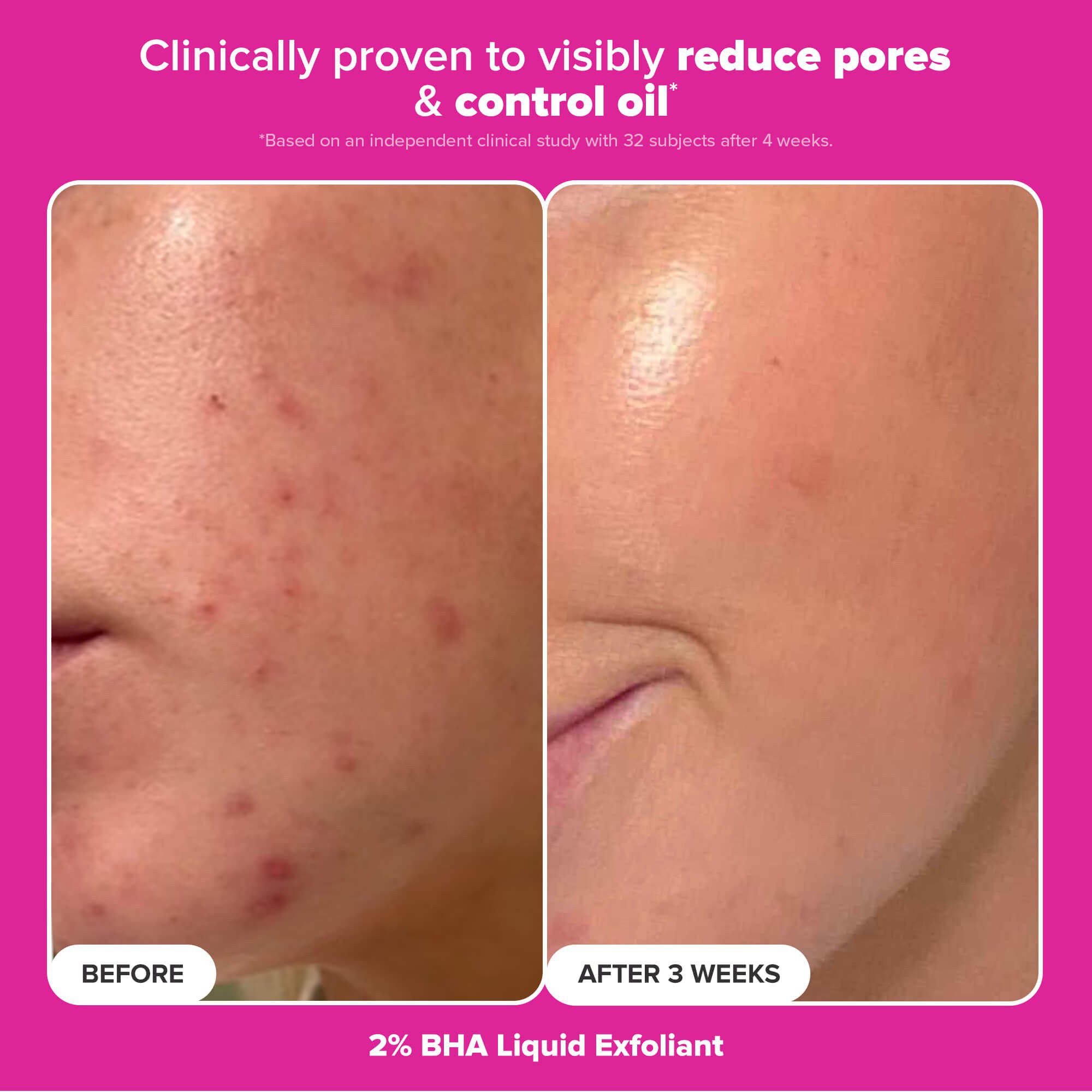 The Plump & Glow Kit