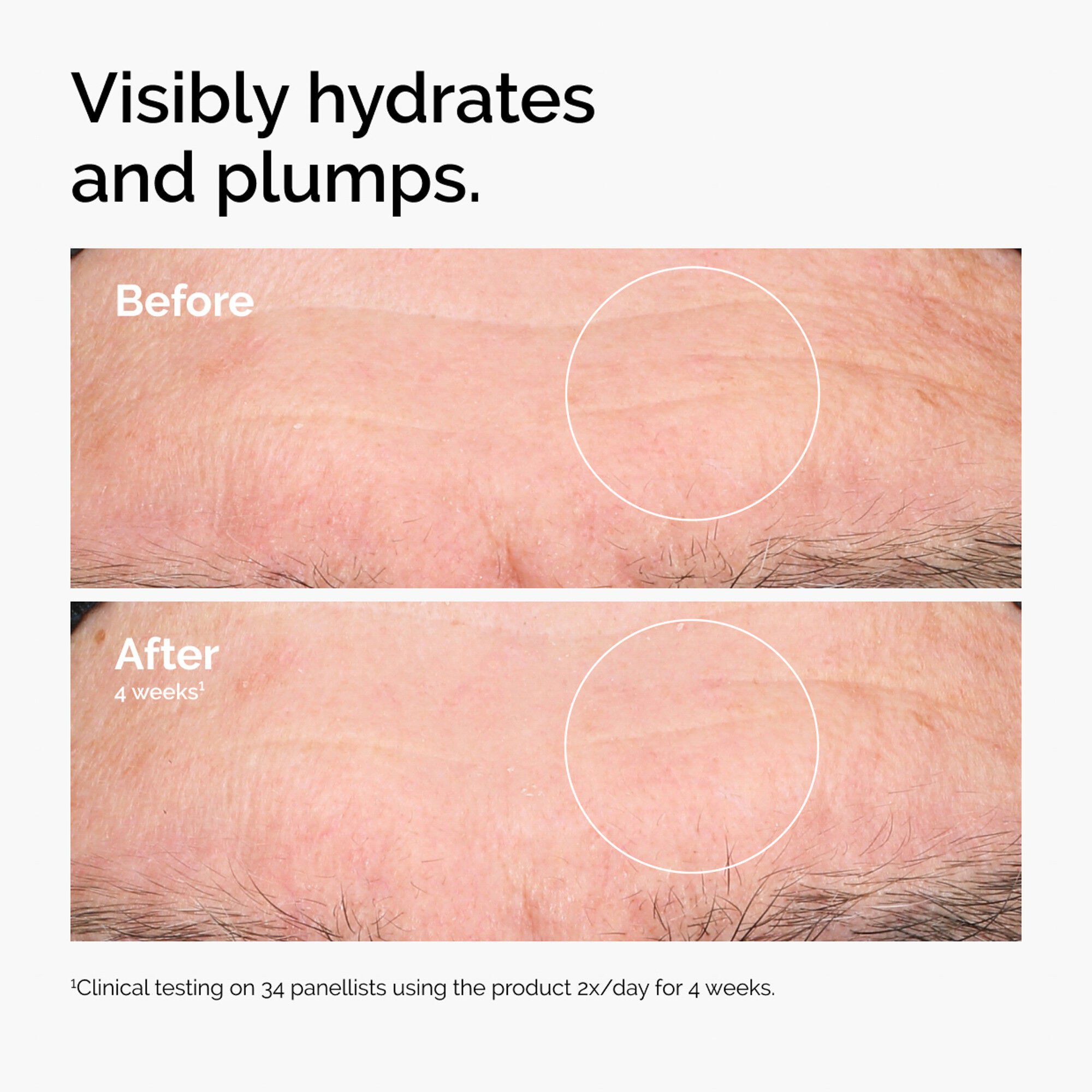 HYALURONIC ACID 2%�+ B5 30ML/1FLOZ