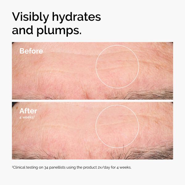 HYALURONIC ACID 2%�+ B5 30ML/1FLOZ