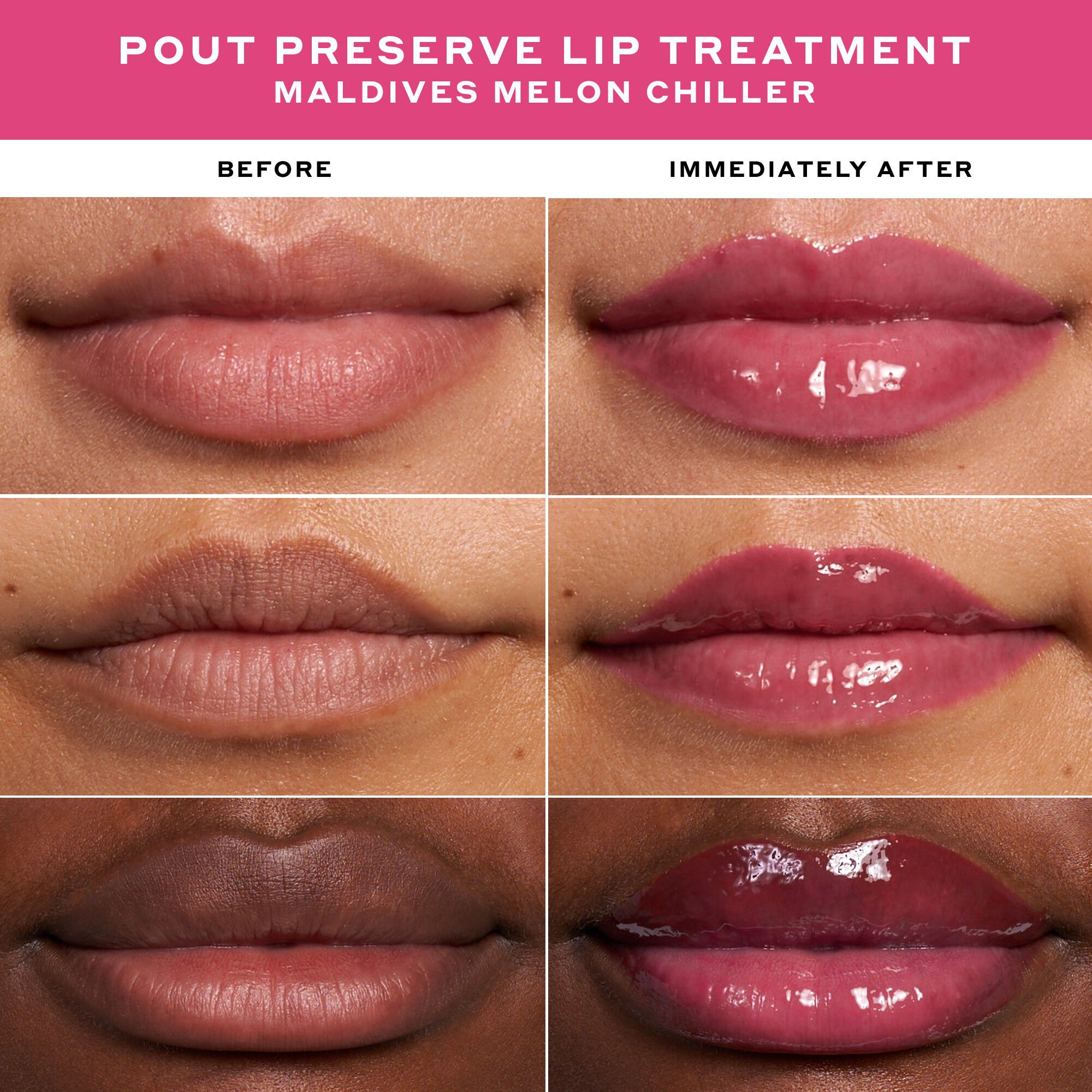 LIP TREATMENT