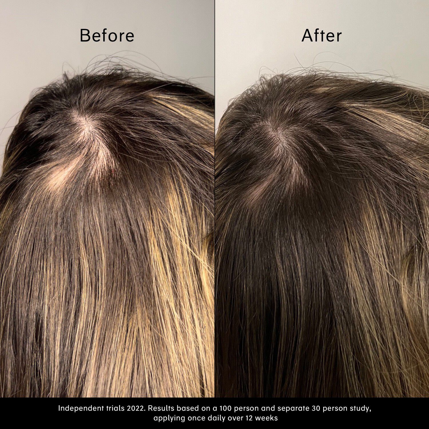 Pitta v&aelig;kstserum - V&aelig;kstserum