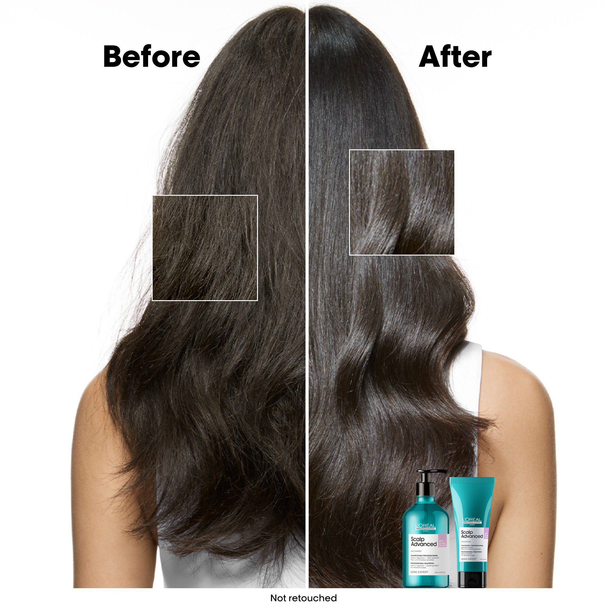L'Or&eacute;al Professionnel Scalp Advanced Anti-Discomfort Shampoo 500ml