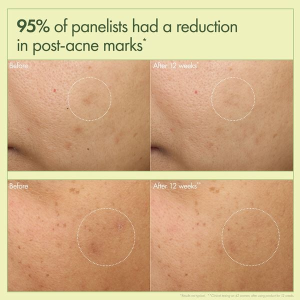 Dr. Weil Mega-Mushroom Dark Spot Correcting Brightening Moisturizer