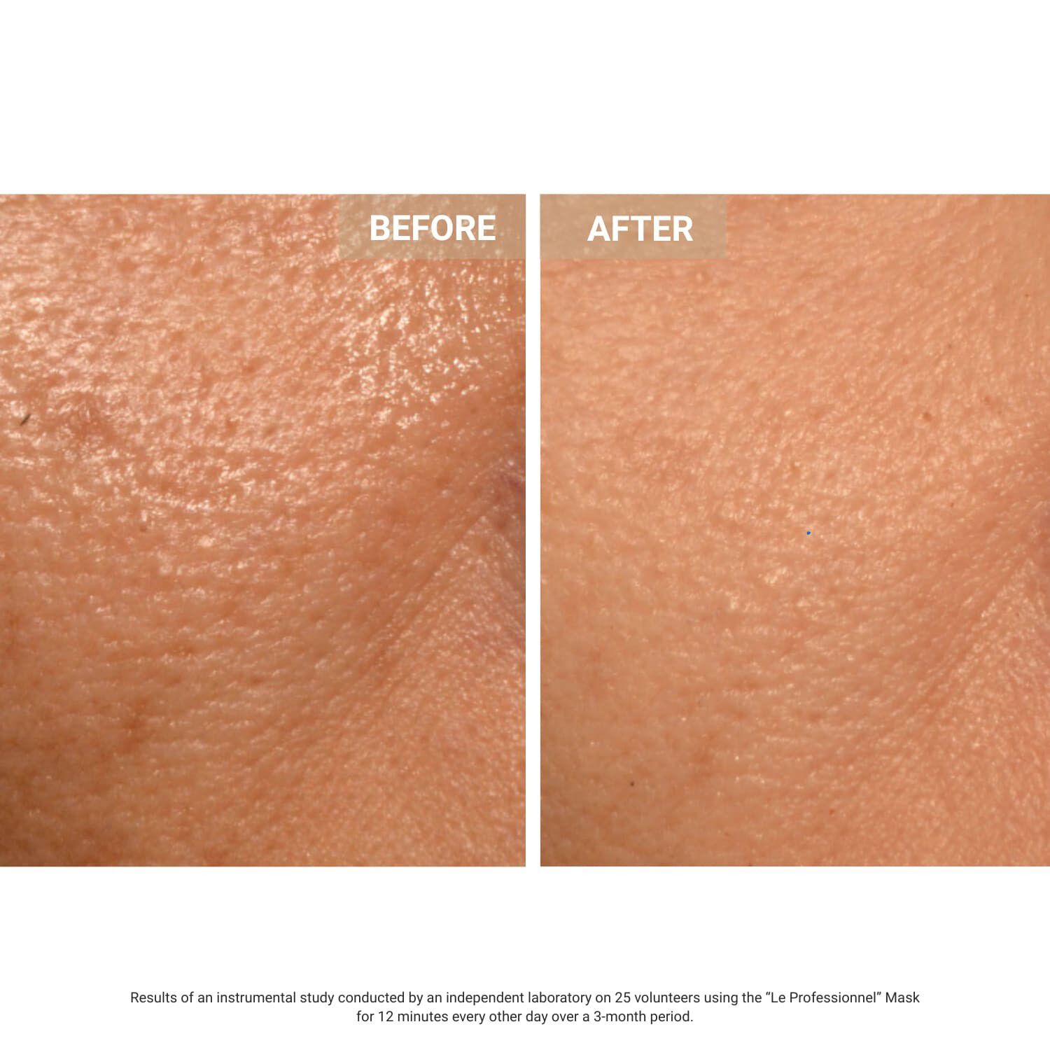 Aurion X252 LED Face Mask - Anti-age LED-ansigtsmaske