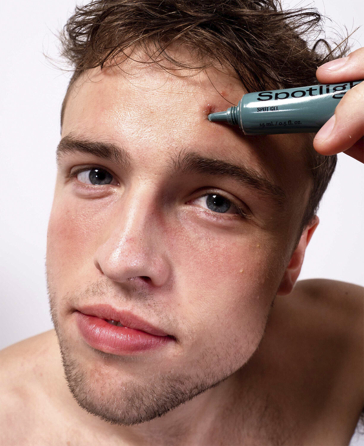 Spotlight - Spot gel til uren hud