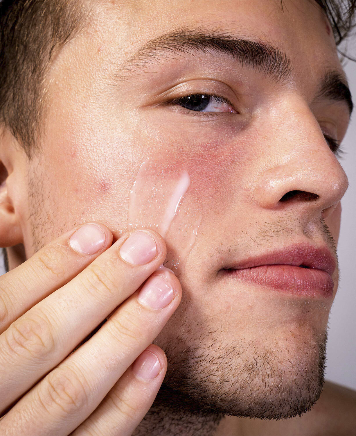 CMD-Z - Clean Skin Kit - bek&aelig;mp urenheder