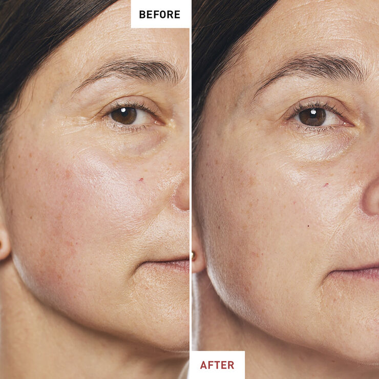 Skin Therapy - Multi-Perfecting Night Oil