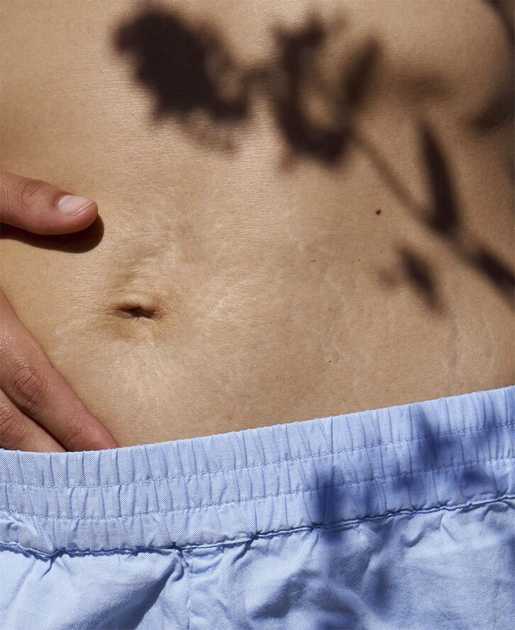 Love Lines - Strækmærke creme