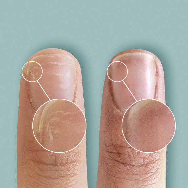 RescueRxx, CND Essentials