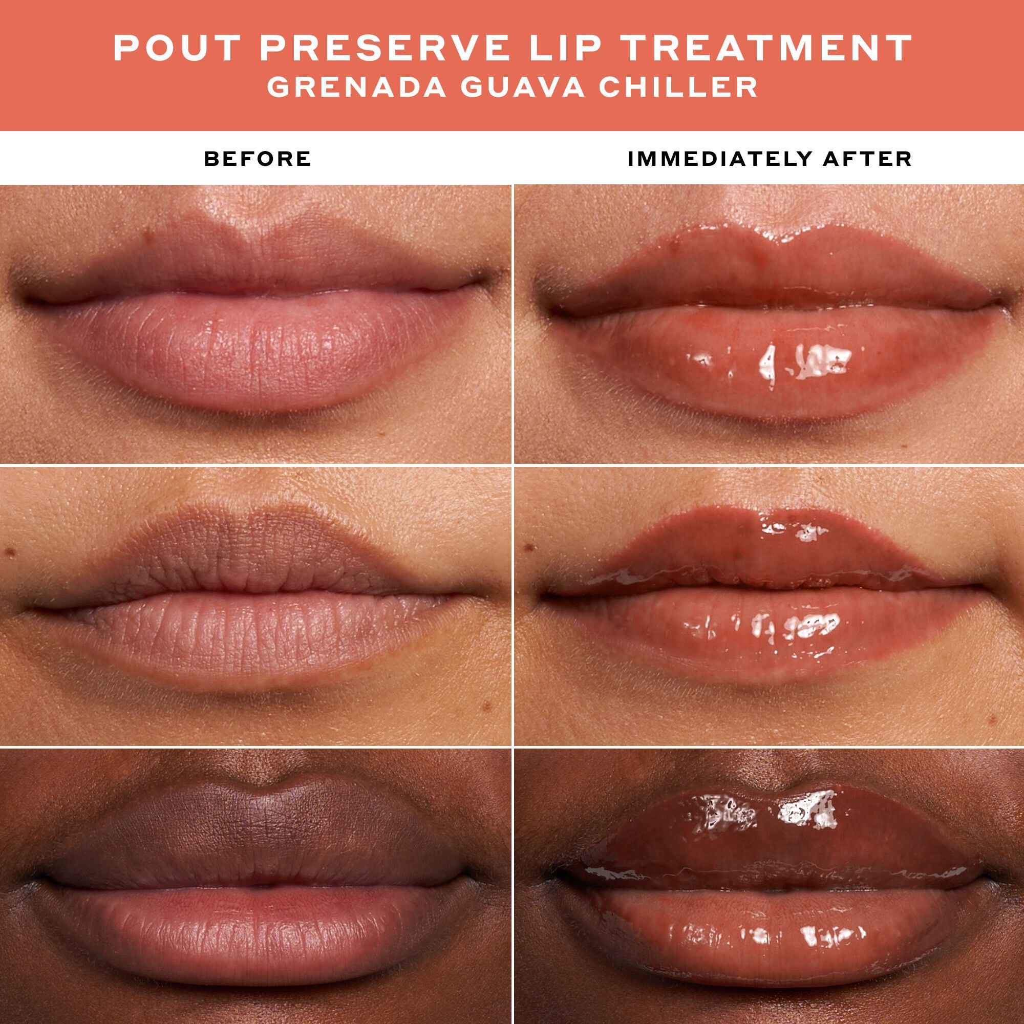 LIP TREATMENT