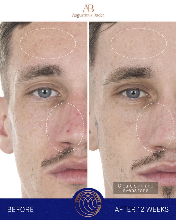 The Retinol Serum 15ml Nomade ROW