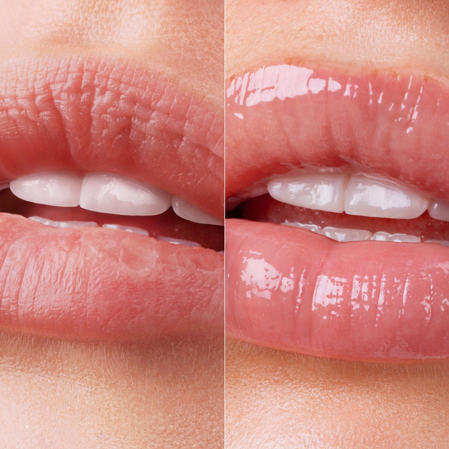 Lip Therapy Glaze Duo - L&aelig;beplejes&aelig;t