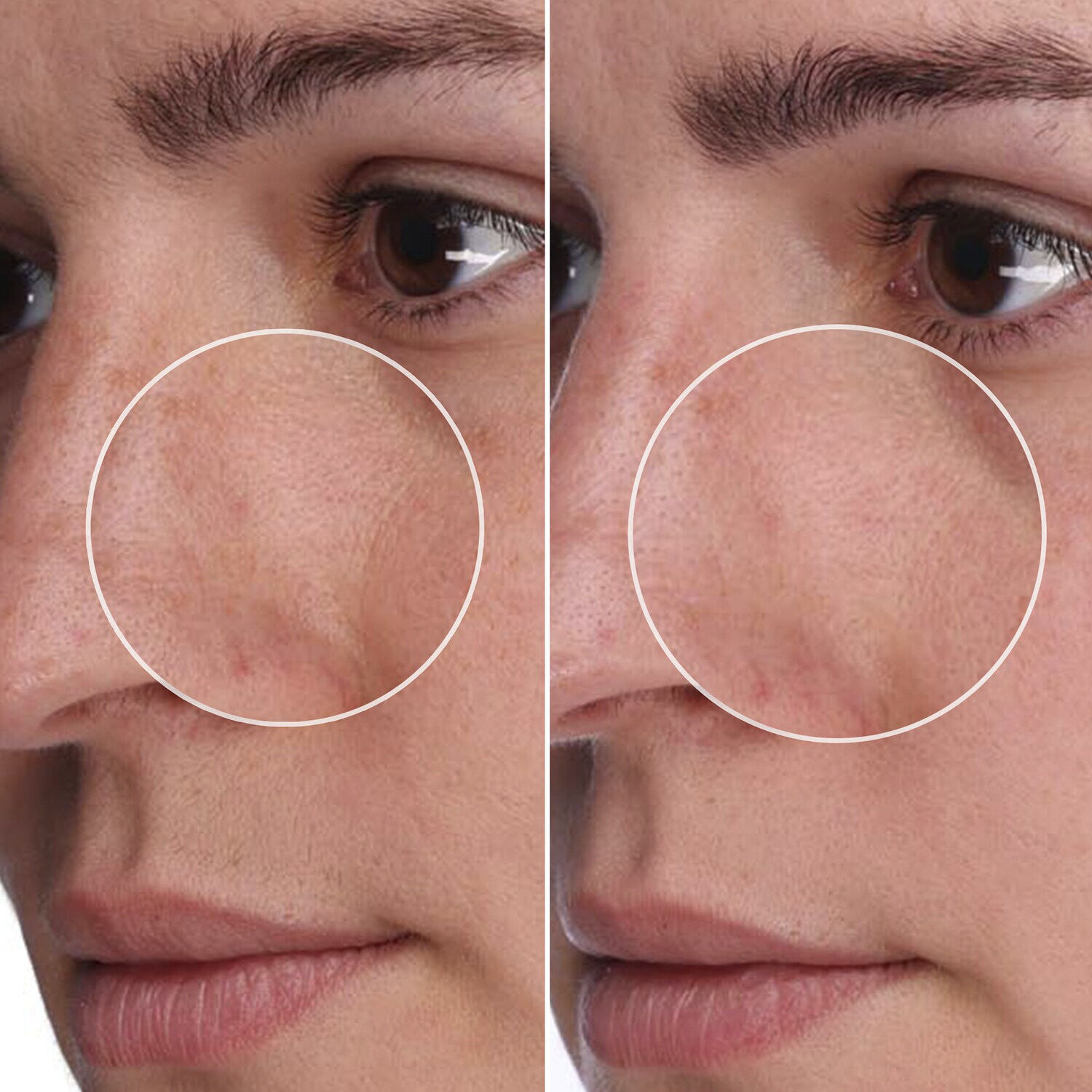 The POREfessional Shrink Wrap - Behandling af store porer