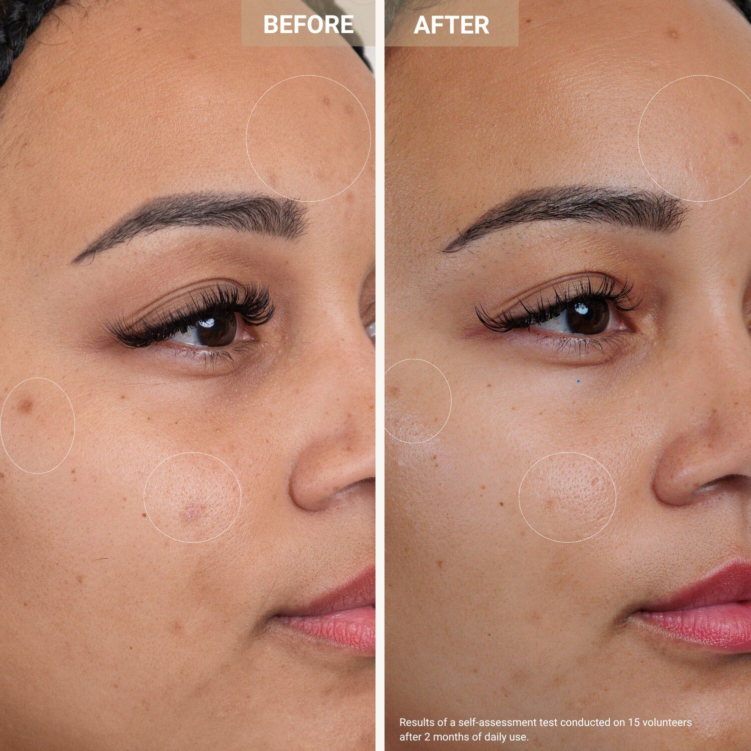 Anti-Redness Clarifying Care - Serum mod r&oslash;dme og urenheder