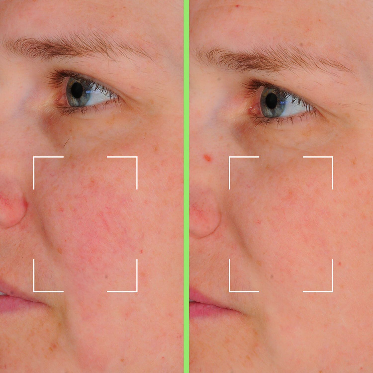 Skin Perfect kapsler - Perfektionsserum beriget med niacinamid, HA og