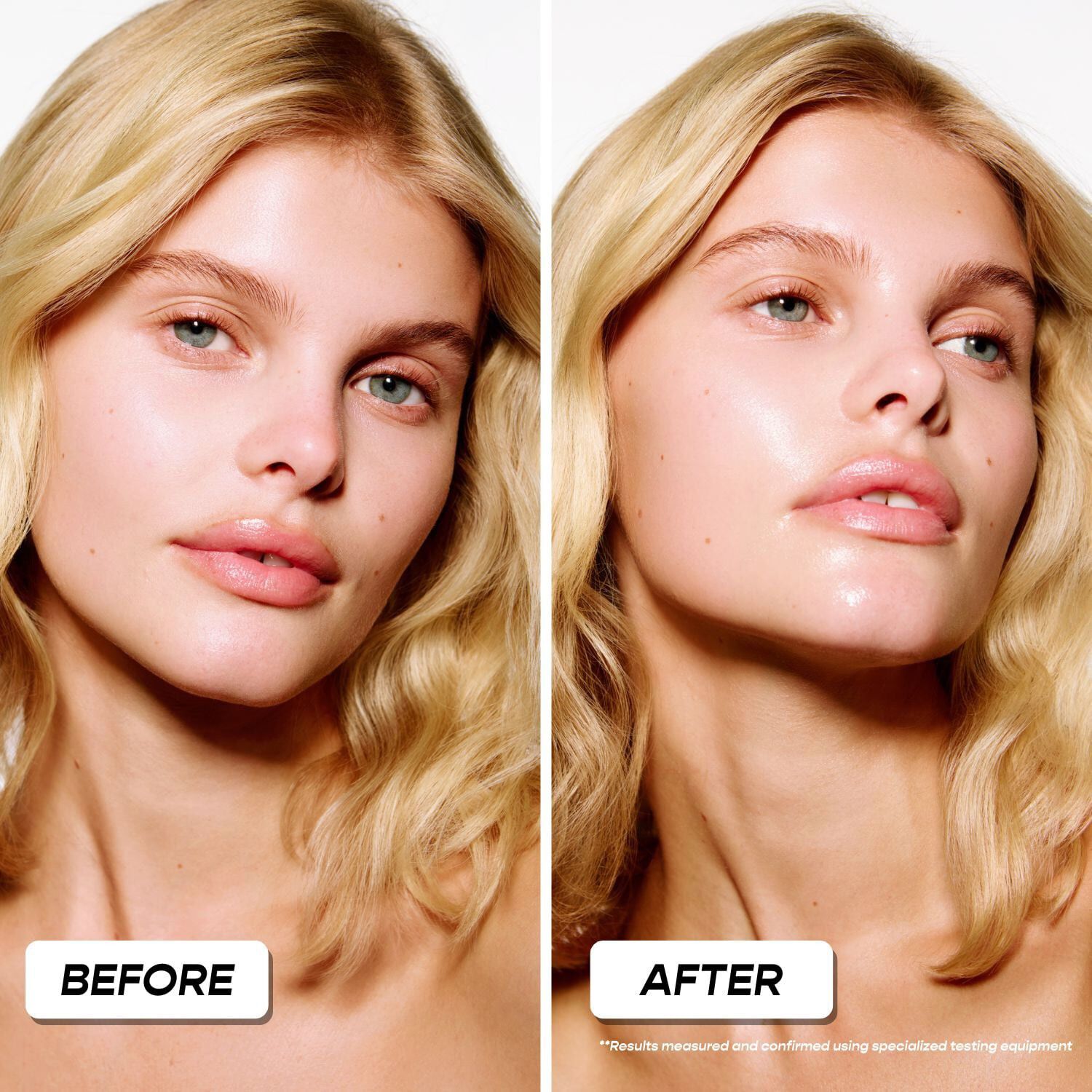 Sunkiss Remedy-Ultra-frisk gelcreme, der giver fylde