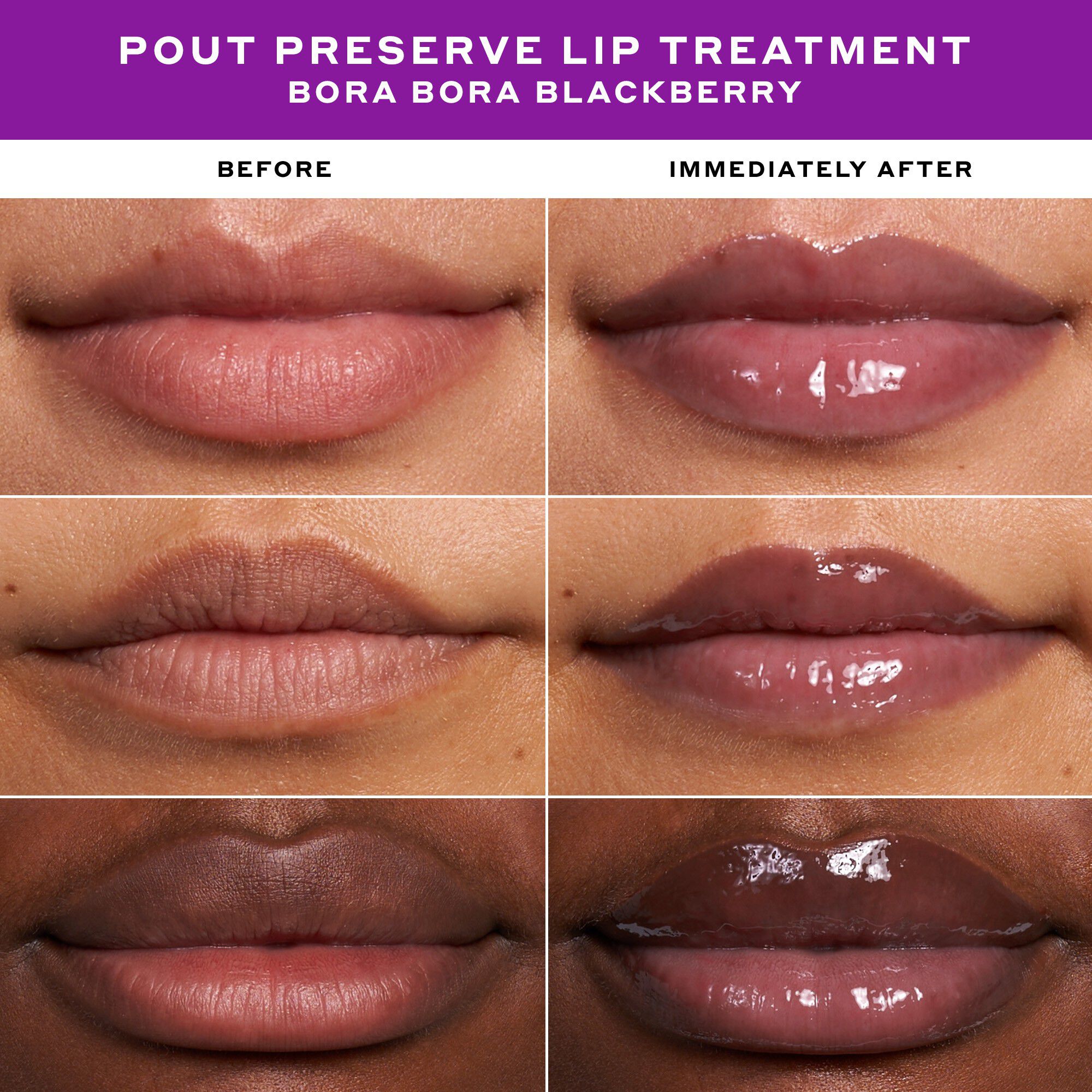 LIP TREATMENT