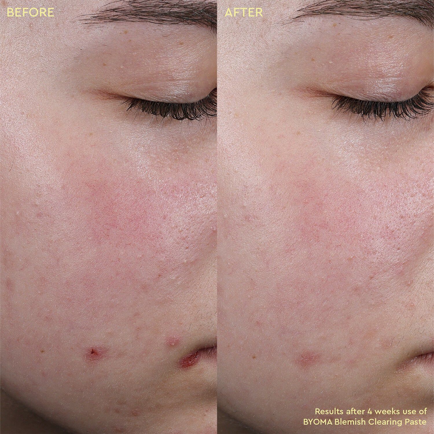 Blemish Clearing Paste - Anti-imperfektionspasta