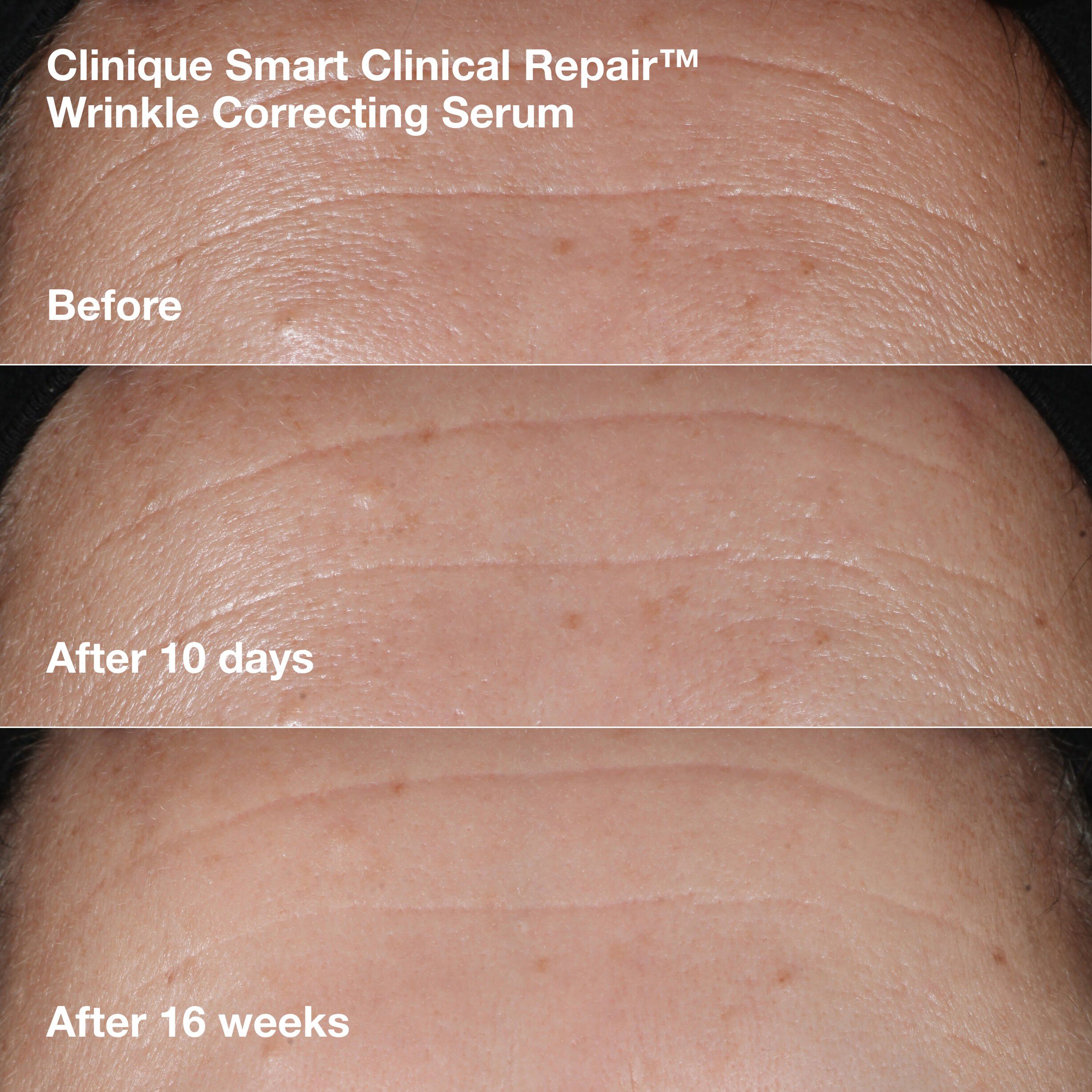 Wrinkle-Correcting Routine Set