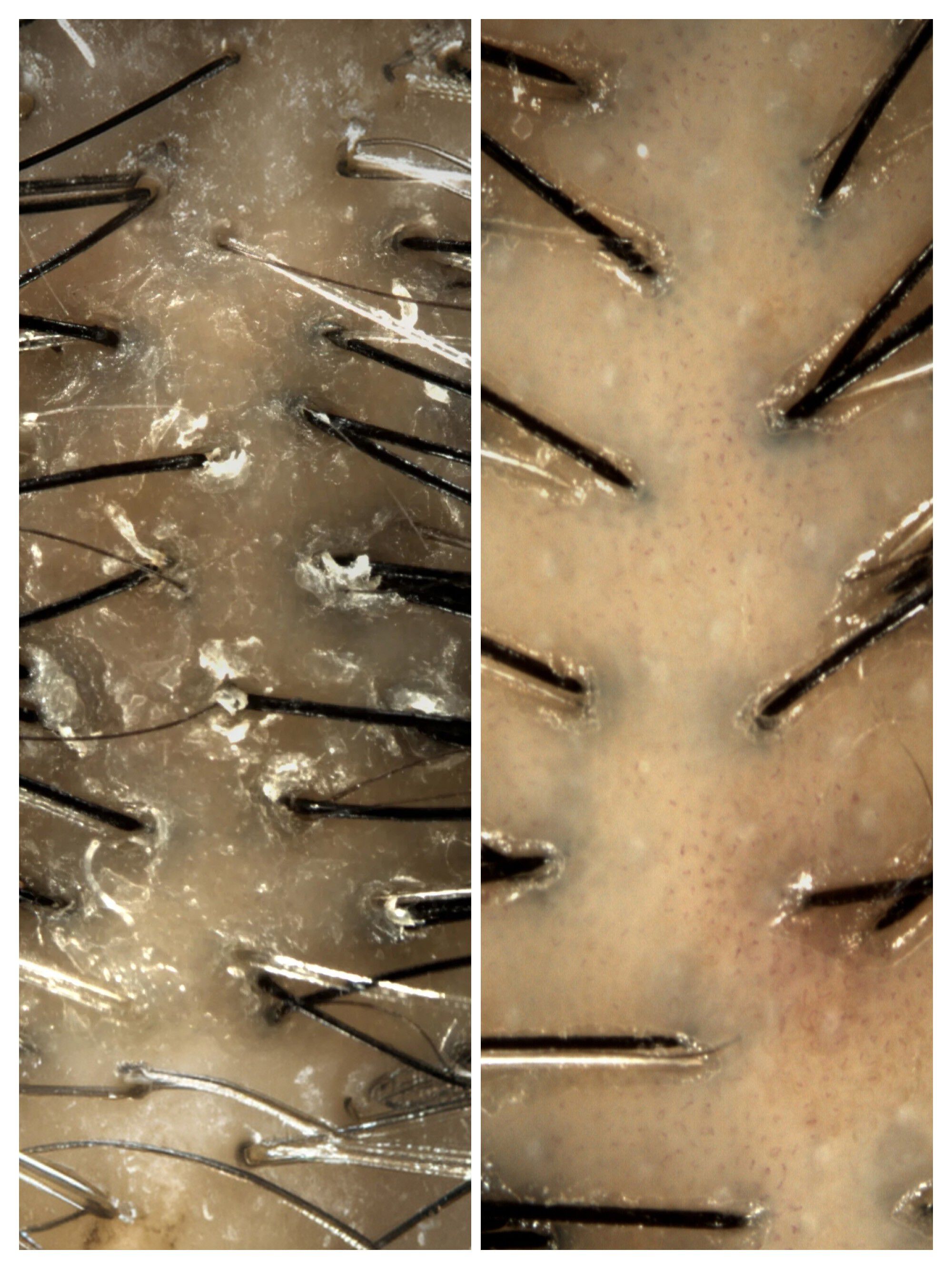 Dyson Amino leave-in scalp bubble treatment