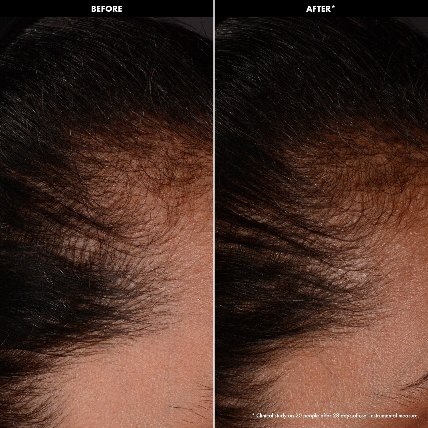 Forst&aelig;rkende og fort&aelig;ttende serum - Hovedbundsserum