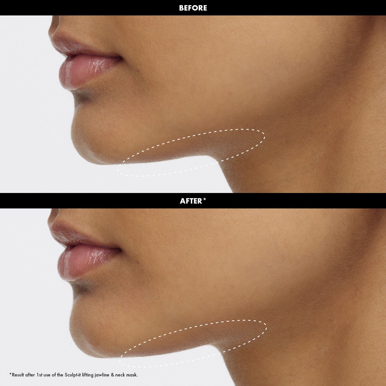 Sculpt-It Mask - Hage- og halsmaske med l&oslash;ftende effekt