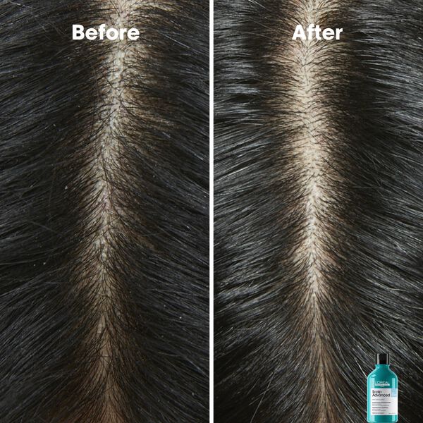 L'Oréal Professionnel Scalp Advanced Anti-Dandruff Shampoo 300ml