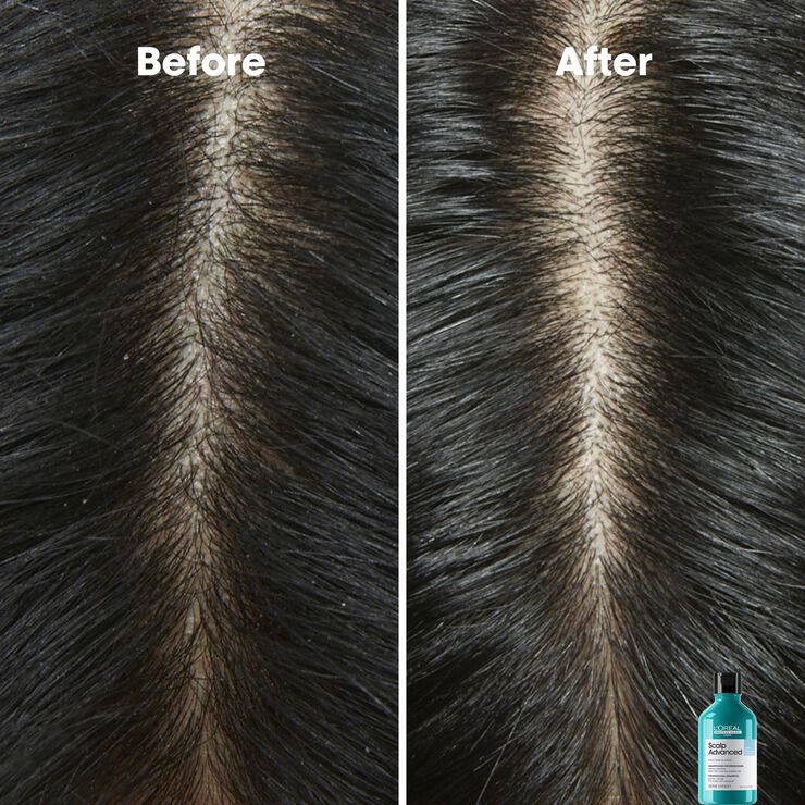 L'Oréal Professionnel Scalp Advanced Anti-Dandruff Shampoo 300ml