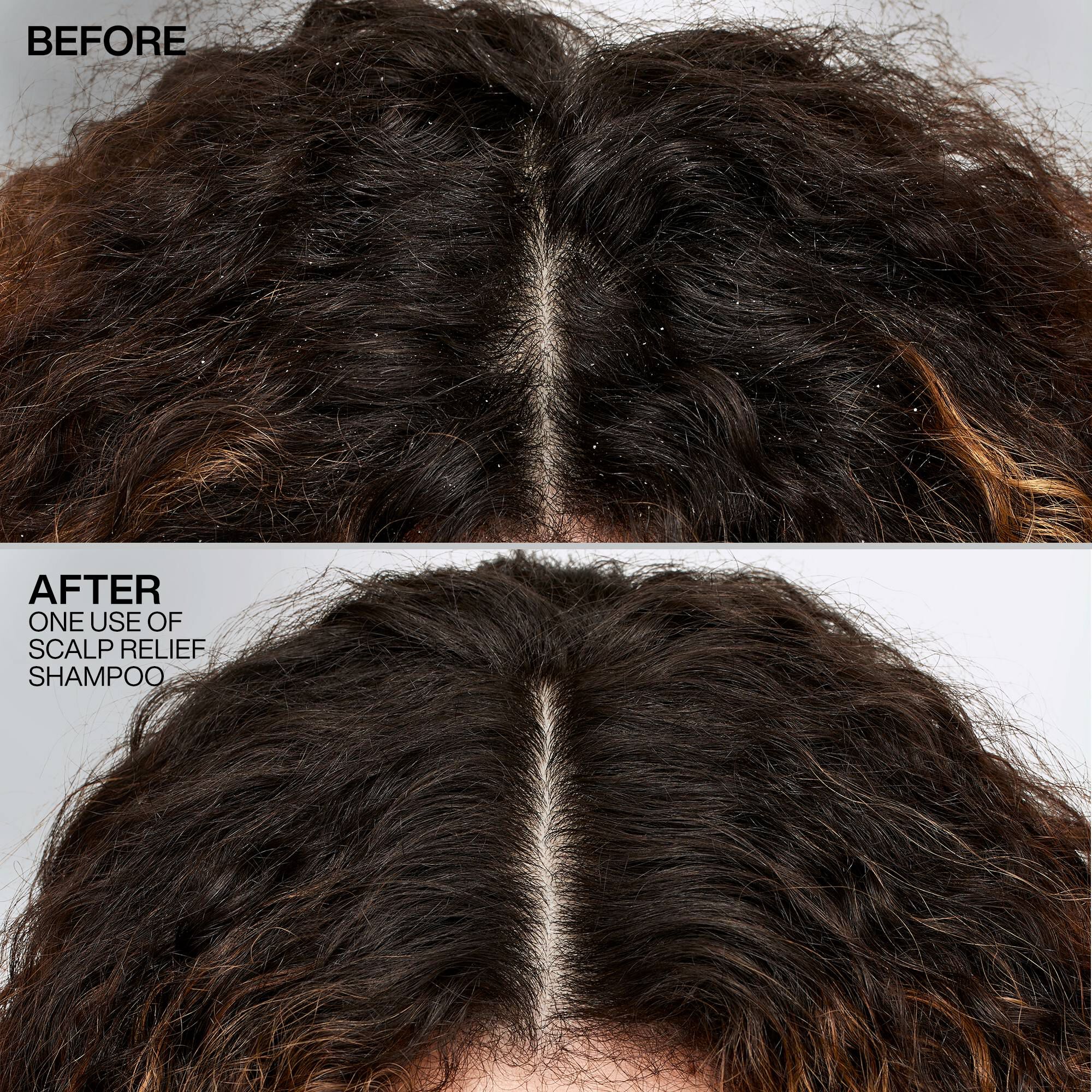 Scalp Relief Dandruff Control Shampoo