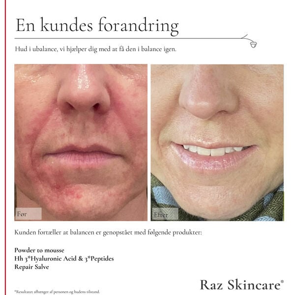 Raz Skincare Hh 3*Hyaluronic Acid & 3*Peptides 30 ml