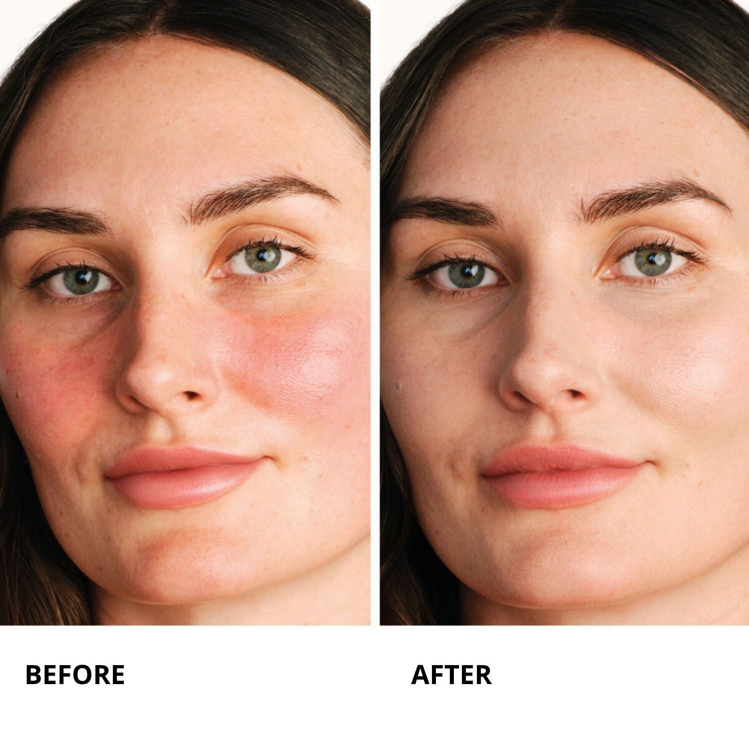 Centella Red Serum - &Oslash;jeblikkeligt beroligende koncentrat