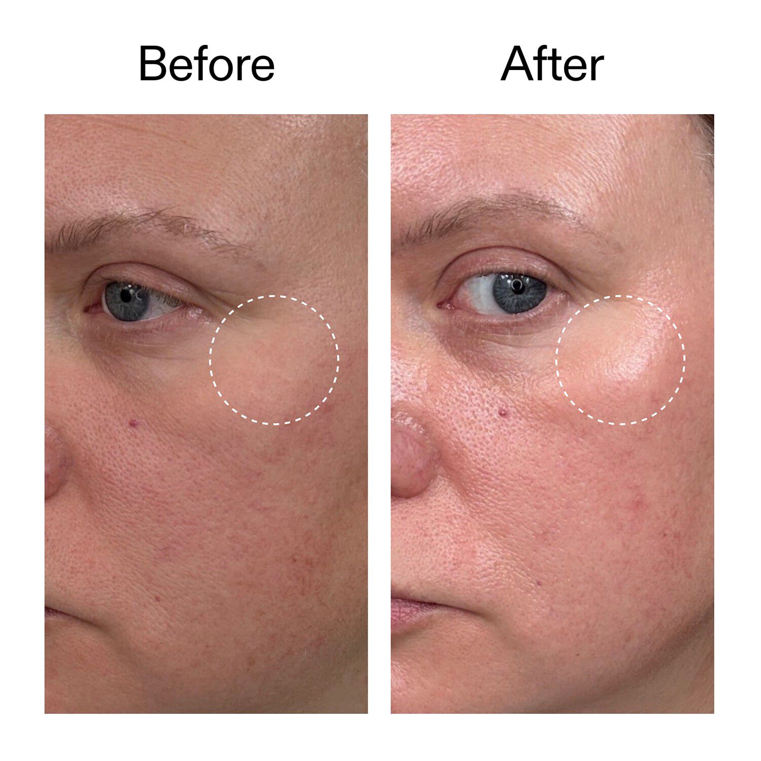 Advanced Retinal Serum - Avanceret retinalserum