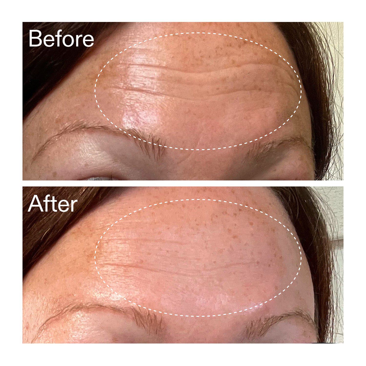 Starter Retinol Serum - Begynderretinolserum