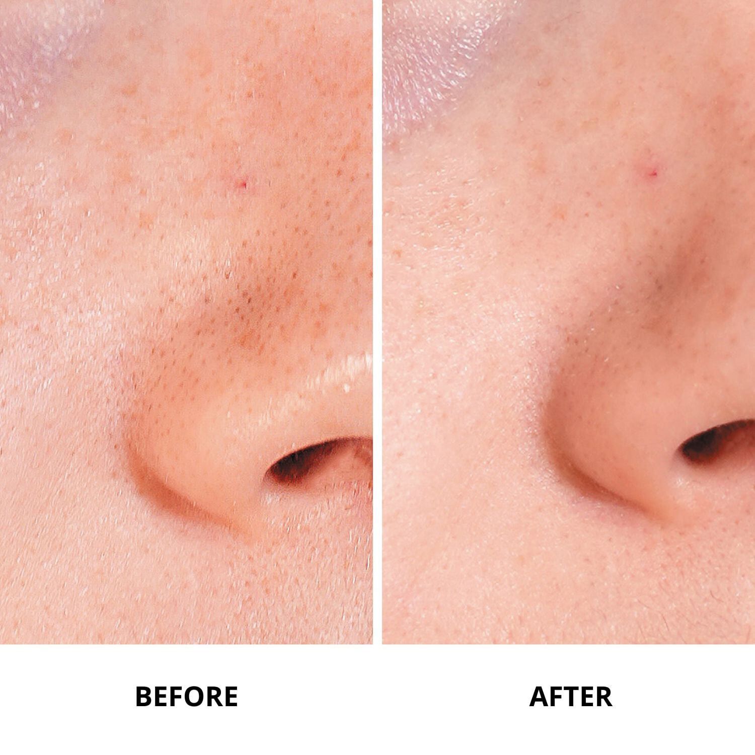 Ginseng Micro Shot 0. 1 - Mikroinfusionsserum, der fornyer hudens teks