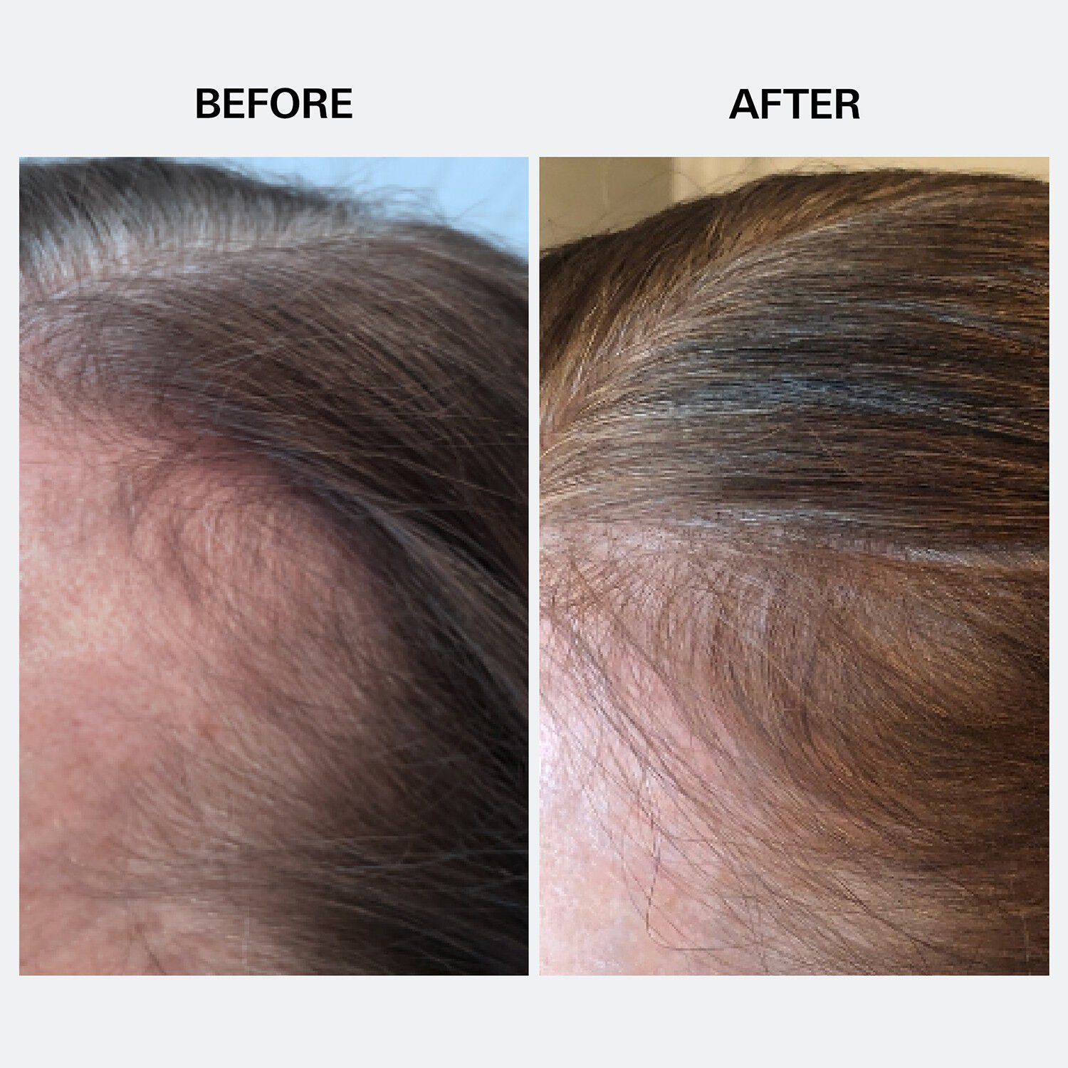 Youth Juice - Kollagenbehandling til hovedbunden