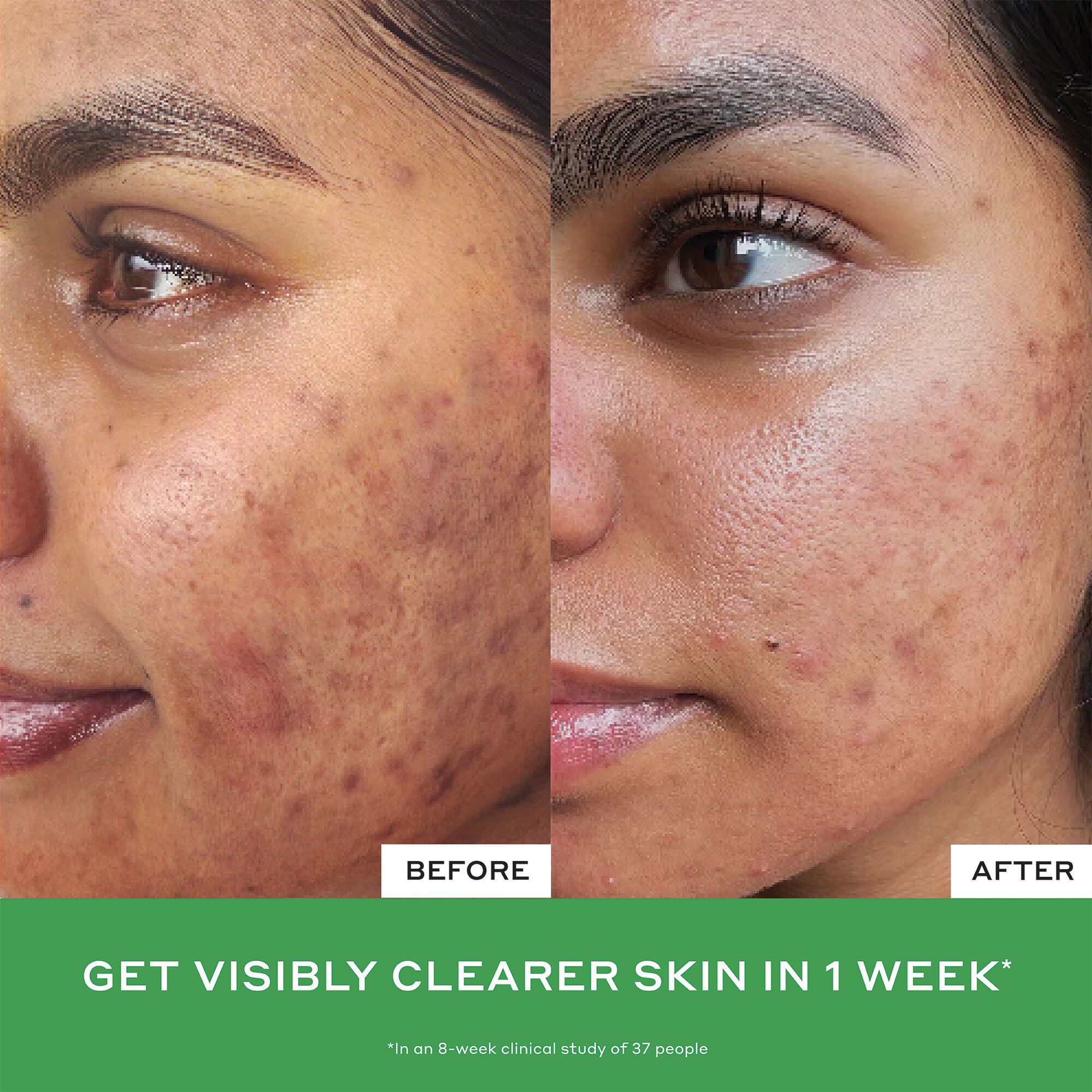 Balance+ Daila D-Clog Pore-Clearing Cleanser