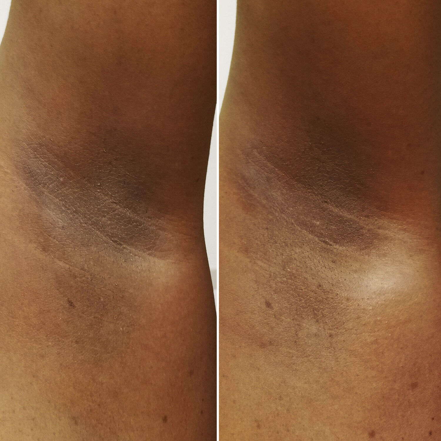 Beija Flor Rio Deo - Deodorant