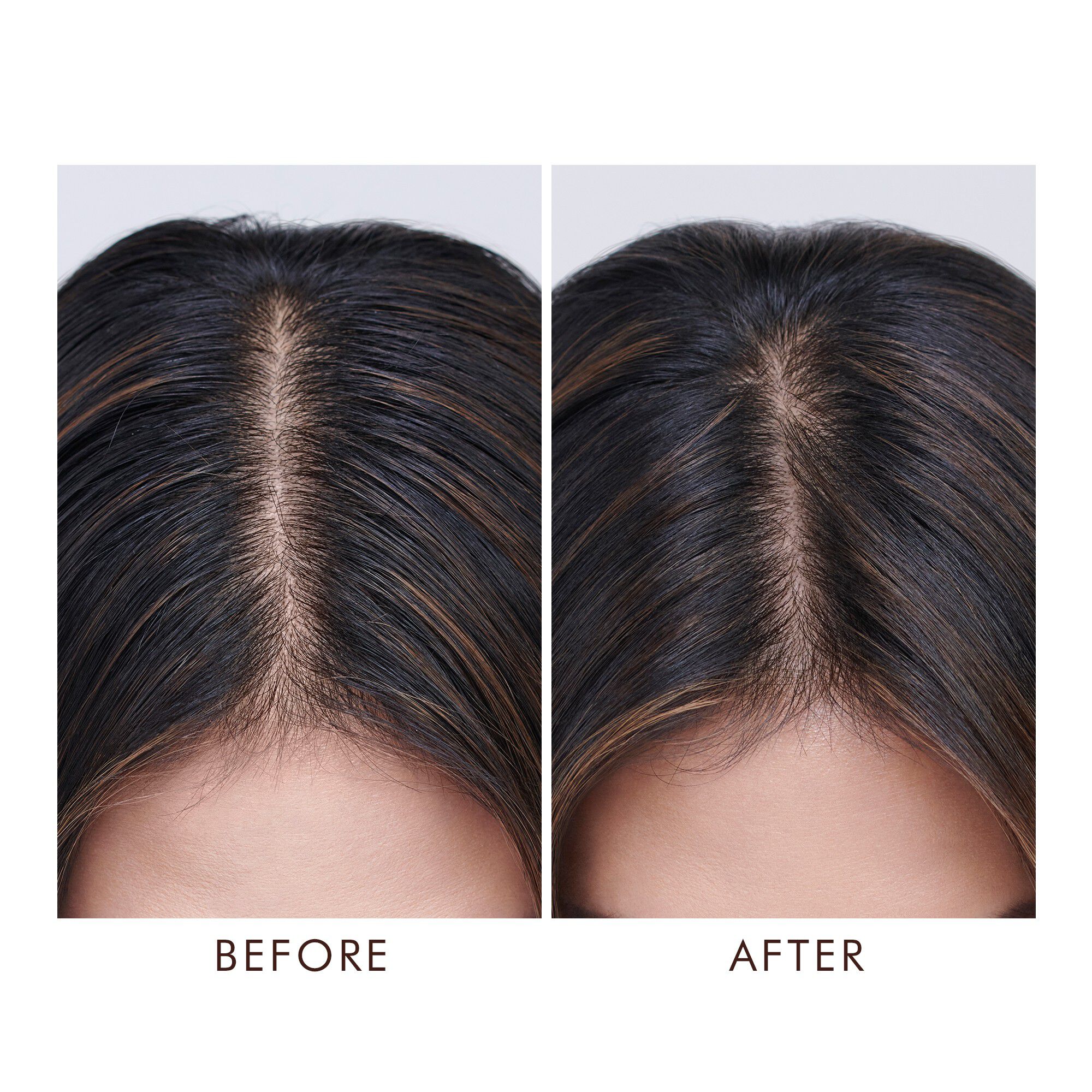 Oily Scalp Treatment, 45 ml.