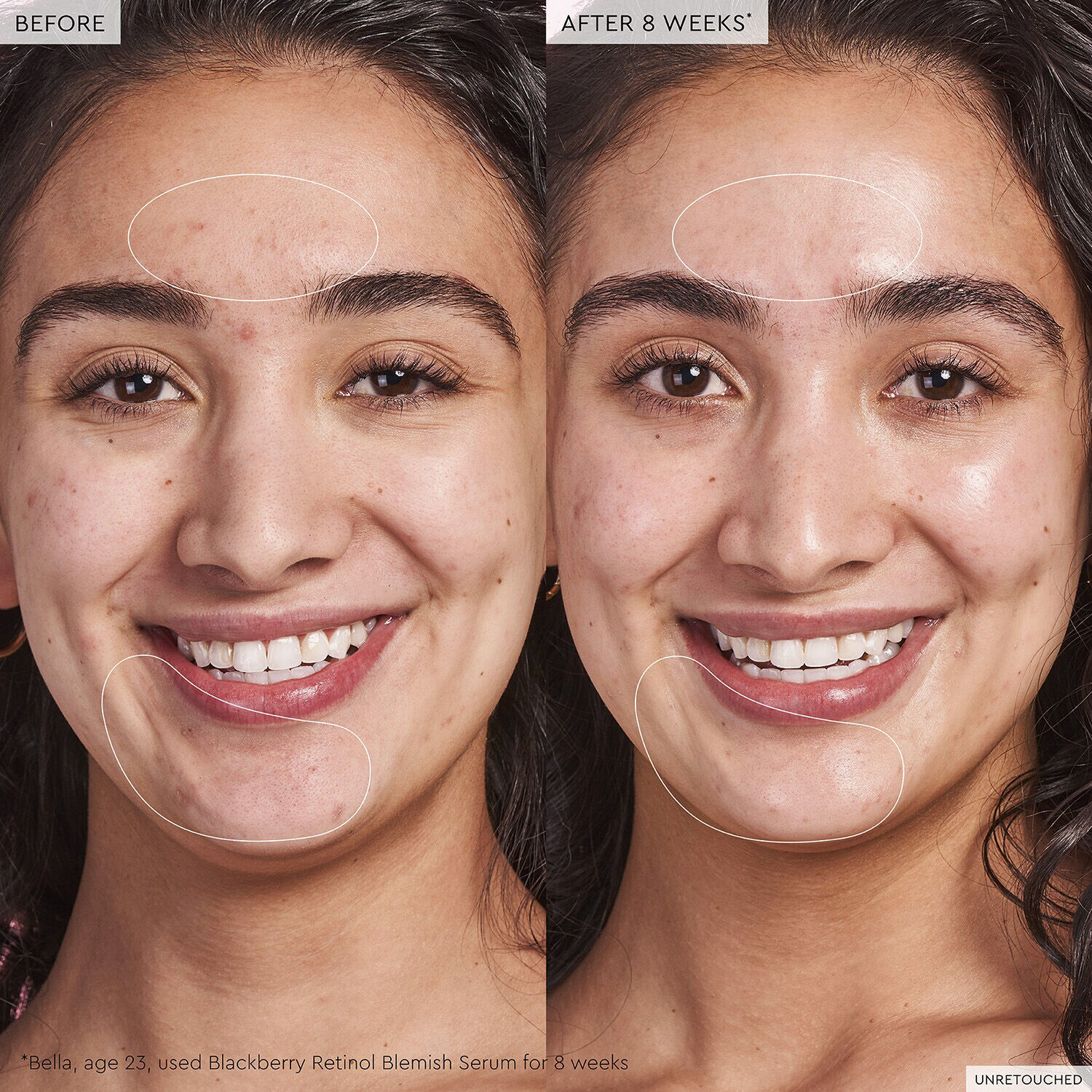 Blackberry Retinol - Reset serum