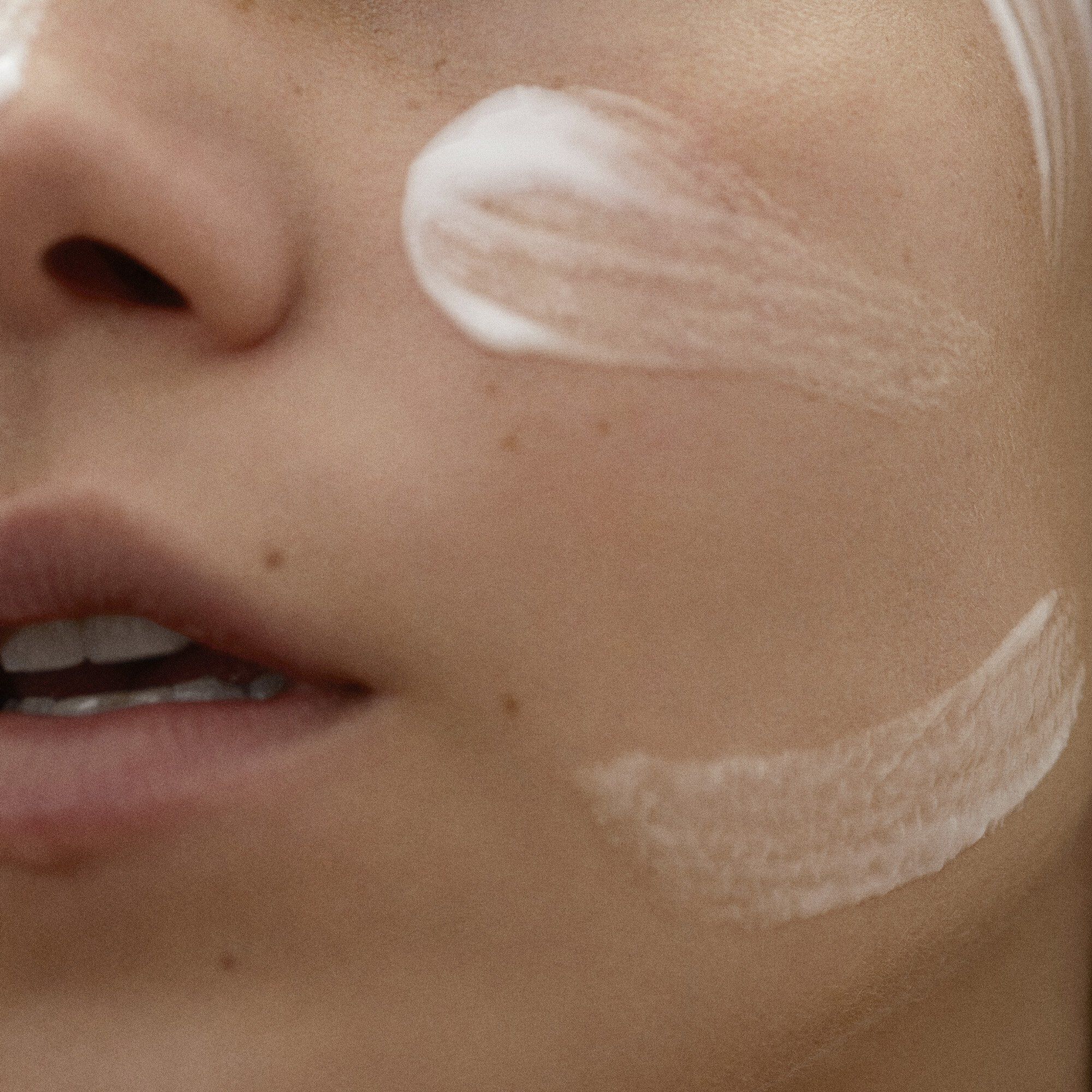 BLEMISH CONTROL CLARIFYING GEL - 75ML